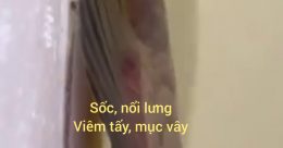 Cá sốc nổi lưng, viêm tấy đỏ , mục vây, chữa bằng MRBIO, không dùng thuốc